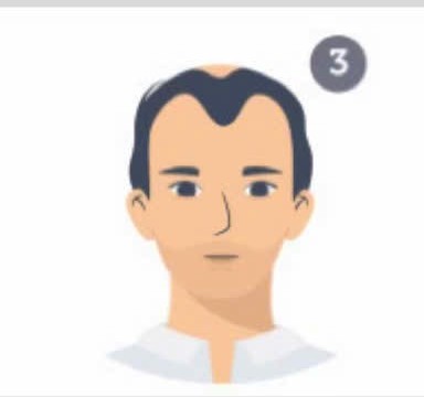 Mức 3